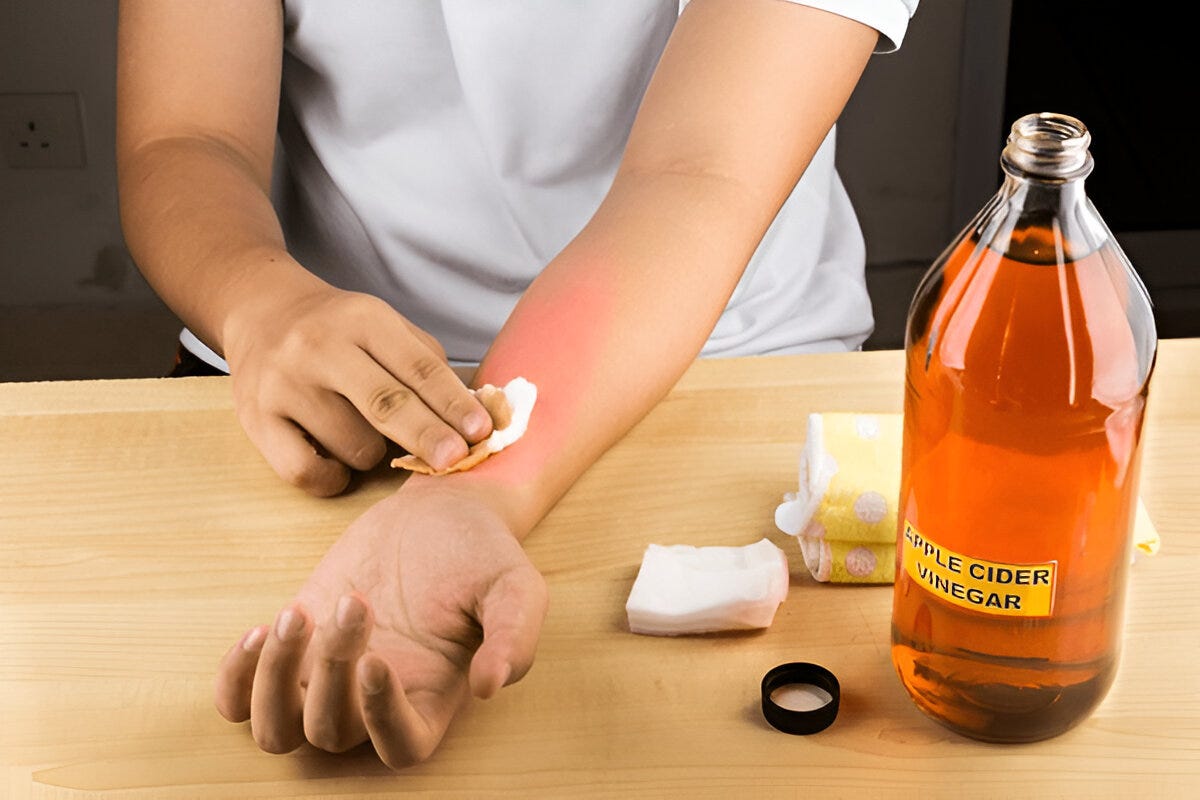 Unlock the Skin Benefits of Apple Cider Vinegar: Natural Beauty Solution