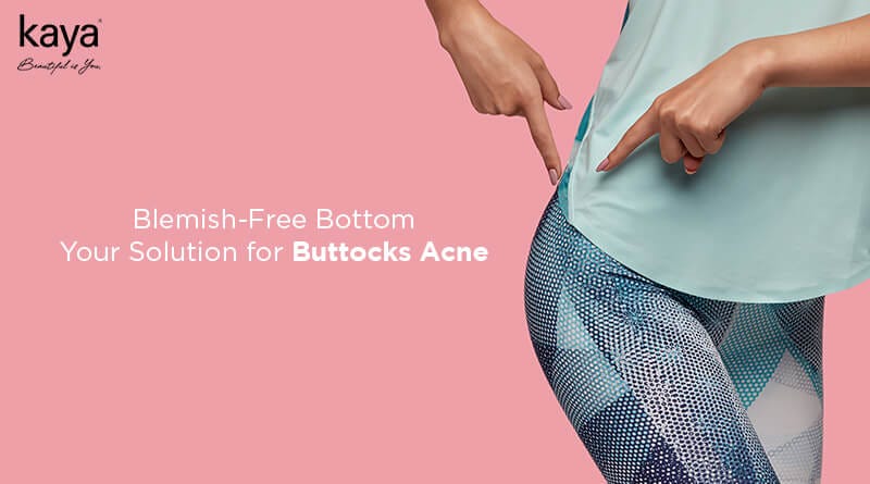 Butt Acne: Causes, Symptoms, Treatment and Preventions
