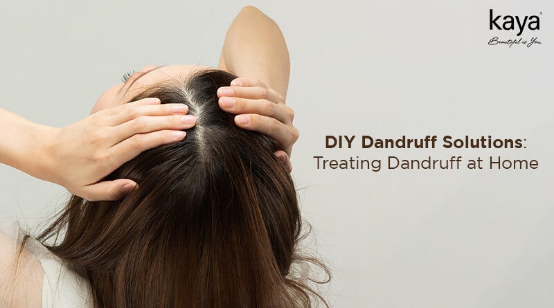 Natural Dandruff Treatment at Home: Tried and Tested Methods