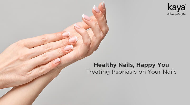 Nail Psoriasis: Causes, Symptoms, and Treatment