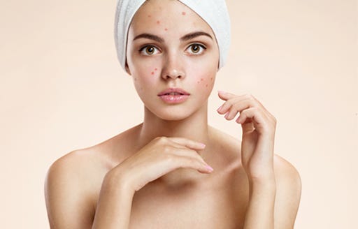 Cystic Acne Treatment