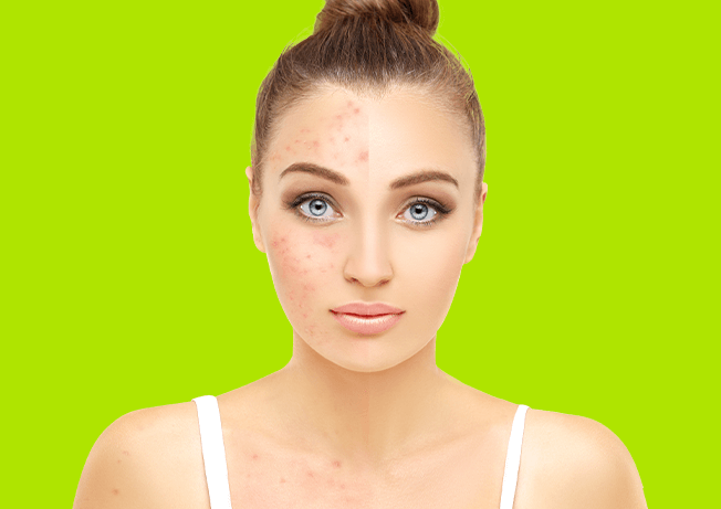 How To Reduce Pigmentation Spots From Face? - Blog
