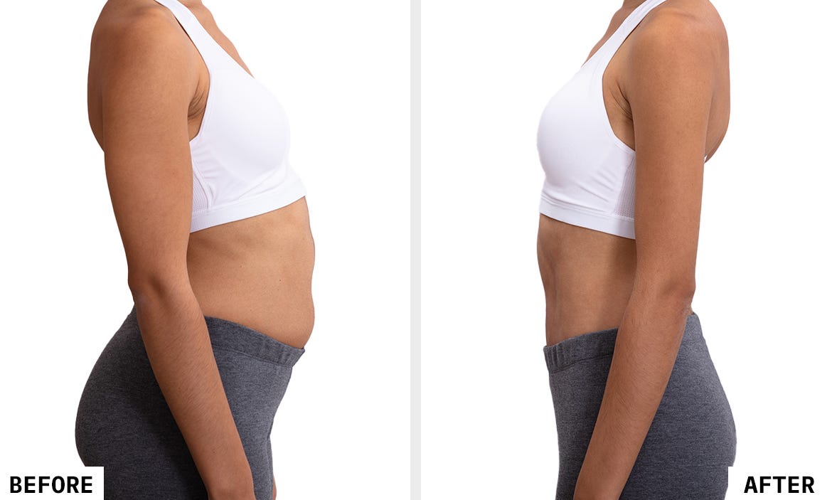 Coolsculpting Treatment In India - Cost And Process